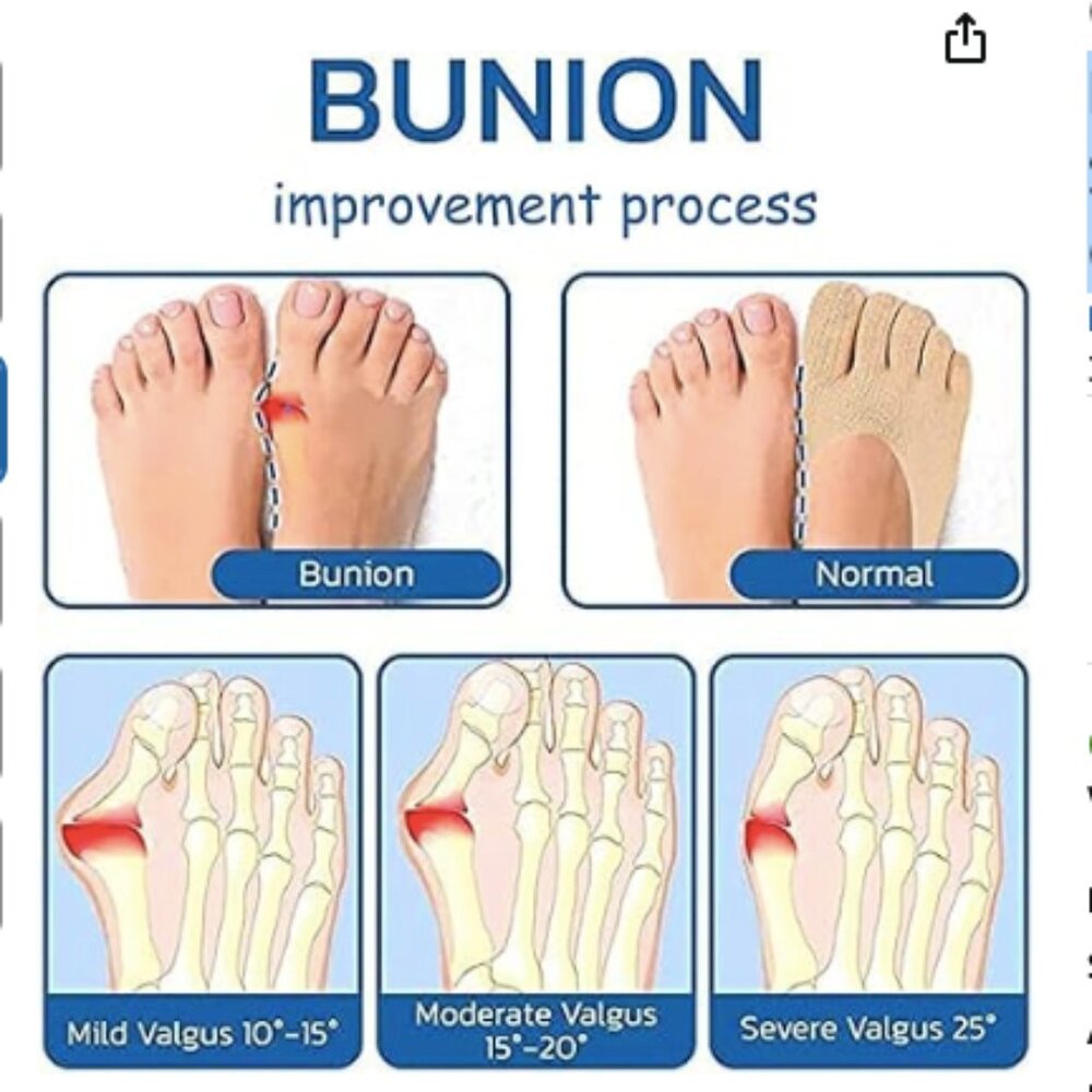 4 Pairs Anti Bunions Socks, Projoint Antibunions Health Sock, Bunion Corrector31 - Picture 3 of 6